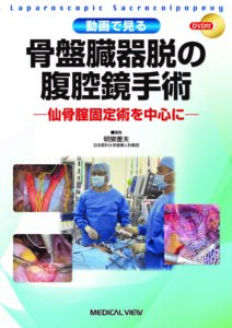 骨盤臓器脱の腹腔鏡手術